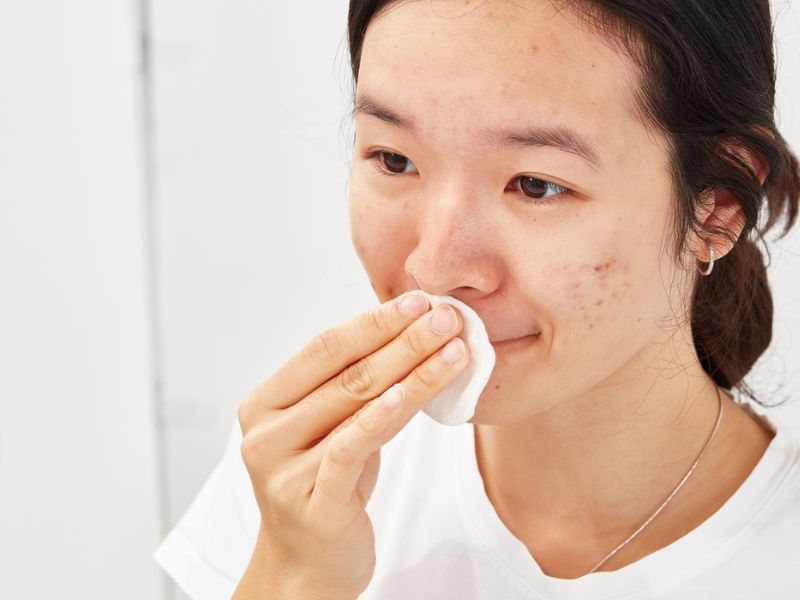 Da khô và sản phẩm chăm sóc